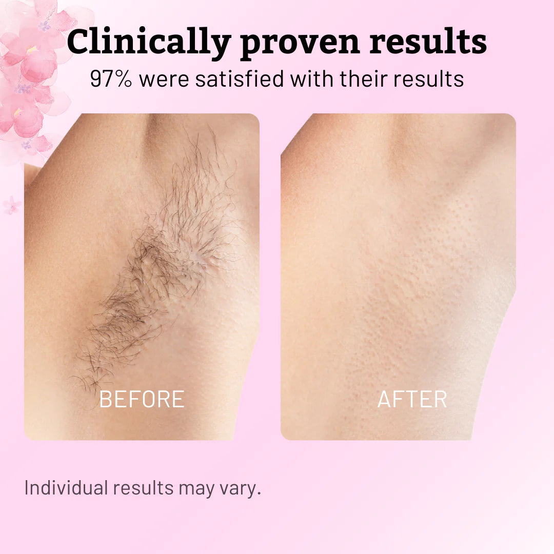 Before and after comparison of hair removal on a pink background with text about satisfaction rates.