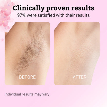 Before and after comparison of hair removal on a pink background with text about satisfaction rates.